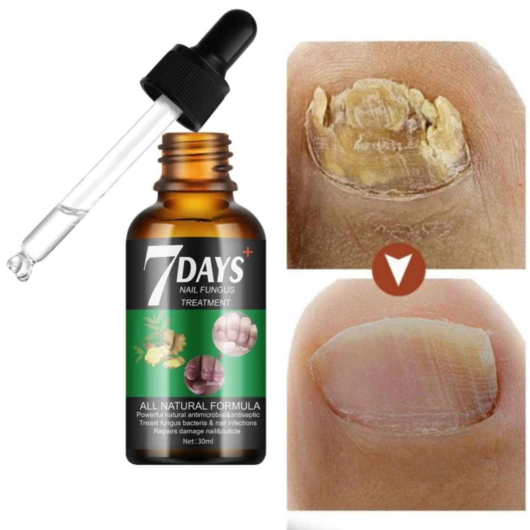 Traitement anti-mycoses des ongles (7 jours)