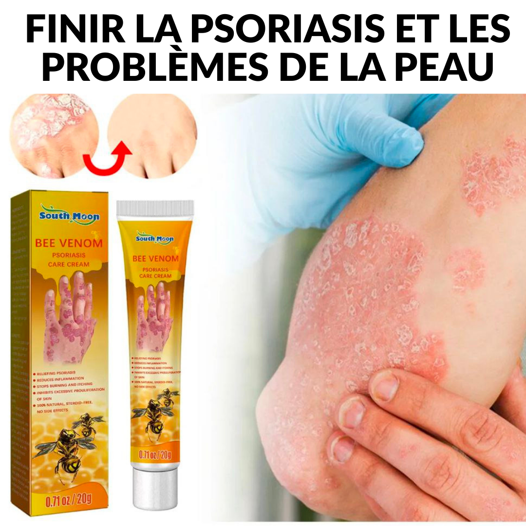 Crème Bee Venom Psoriasis