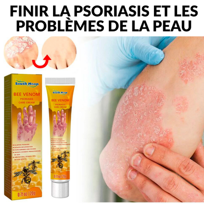 Crème Bee Venom Psoriasis