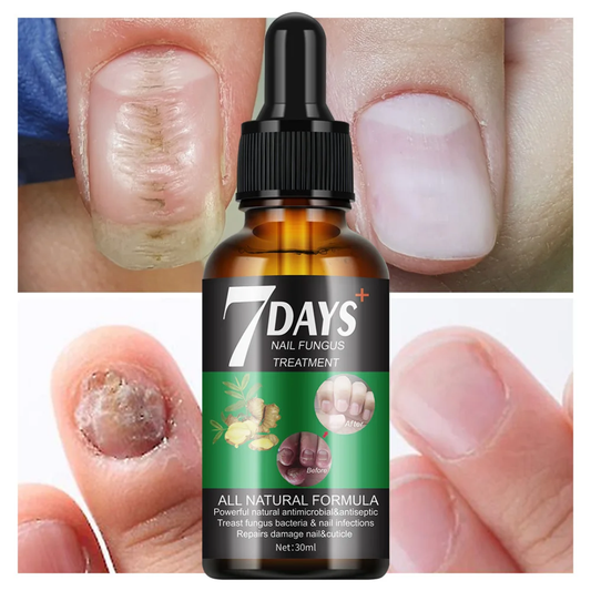 Traitement anti-mycoses des ongles (7 jours)
